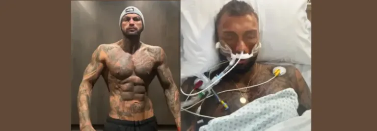 Extreme Diet With Only 5 Foods, Bodybuilder Left In A Coma Due To ...